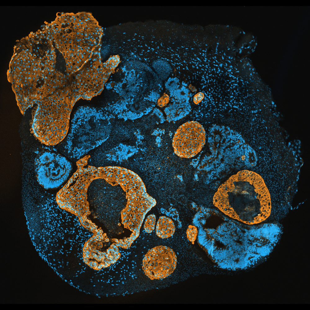 Ex Vivo Tissue Culture